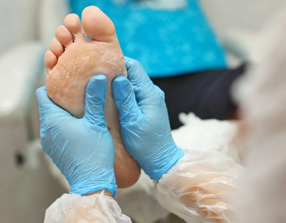 woman hands in gloves massage the feet with a pedicure, smear cream on the foot. Foot care salon, doctor podiatrist treatment office